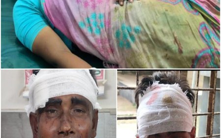 ইরানি হামলায় ক্ষতিগ্রস্ত মার্কিন ঘাঁটিগুলোর ভয়াবহ অবস্থা