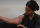 পুলিশি নির্যাতনের বর্ণনা দিলেন ভারতের বিক্ষোভকারীরা